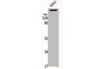 Western Blot analysis of K562 cells using MRCKa Polyclonal Antibody