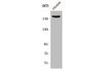Western Blot analysis of COLO205 cells using MRCK