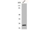 Western Blot analysis of COLO205 cells using NBK Polyclonal Antibody