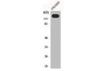 Western Blot analysis of K562 cells using N-cadherin Polyclonal Antibody