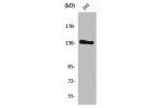 Western Blot analysis of 293 cells using Neu Polyclonal Antibody