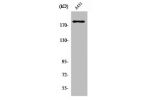 Western Blot analysis of A431 cells using Neu Polyclonal Antibody