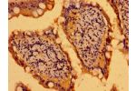 Immunohistochemistry of paraffin-embedded human small intestine tissue using CSB-PA003434LA01HU at dilution of 1:100