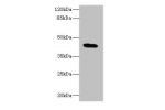Western blot<br />
All lanes: C19orf47 antibody at 10ug/ml+ Mouse muscle tissue<br />
Goat polyclonal to rabbit at 1/10000 dilution<br />
Predicted band size: 45,38,30 kDa<br />
Observed band size: 45 kDa<br />