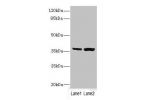 Western blot<br />
All lanes: C1GALT1C1 antibody at 3.97ug/ml<br />
Lane 1 : Mouse gonadal tissue<br />
Lane 2 : Mouse liver tissue<br />
 Goat polyclonal to Rabbit IgG at 1/10000 dilution<br />
Predicted band size: 36 kDa<br />
Observed band size: 36 kDa