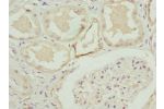 Immunohistochemistry of paraffin-embedded human kidney tissue using CSB-PA003490ESR2HU at dilution 1:100