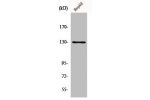 Western Blot analysis of HepG2 cells using p130 Cas Polyclonal Antibody