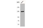 Western Blot analysis of HuvEc cells using p130 Cas Polyclonal Antibody