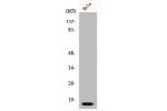 Western Blot analysis of HeLa cells using p14 Polyclonal Antibody