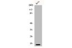Western Blot analysis of HeLa cells using p16 Polyclonal Antibody