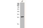 Western Blot analysis of 293 cells using p27 Polyclonal Antibody