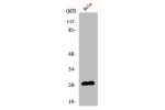 Western Blot analysis of COLO205 cells using p27 Polyclonal Antibody