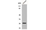 Western Blot analysis of COLO205 cells using p27 Polyclonal Antibody