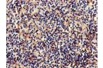 Immunohistochemistry of paraffin-embedded human spleen tissue using CSB-PA003637LA01HU at dilution of 1:100