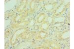Immunohistochemistry of paraffin-embedded human kidney using CSB-PA003638ESR1HU at dilution 1:100