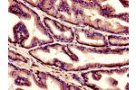 Immunohistochemistry of paraffin-embedded human prostate tissue using CSB-PA003641LA01HU at dilution of 1:100