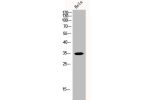 Western Blot analysis of HELA cells using p35 Polyclonal Antibody