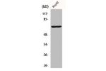 Western Blot analysis of HepG2 cells using p68 RNA Helicase Polyclonal Antibody