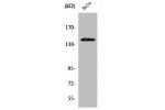 Western Blot analysis of HepG2 cells using PERK Polyclonal Antibody
