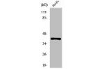 Western Blot analysis of Jurkat cells using pICln Polyclonal Antibody