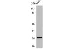 Western Blot analysis of HuvEc cells using PP32R1 Polyclonal Antibody