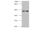 Western blot<br />
All lanes: Eukaryotic initiation factor 4A-II antibody at 2ug/ml<br />
Lane 1 : EC109 whole cell lysate<br />
Lane 2 : 293T whole cell lysate<br />
Secondary<br />
Goat polyclonal to Rabbit IgG at 1/15000 dilution<br />
Predicted band s