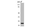 Western Blot analysis of 293 cells using PUMA Polyclonal Antibody