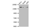 Western Blot<br />
Positive WB detected in:Hela whole cell lysate,HepG2 whole cell lysate,293T whole cell lysate<br />
All lanes:C4A antibody at 3.9