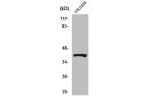 Western Blot analysis of HeLa cells using Renin Receptor Polyclonal Antibody
