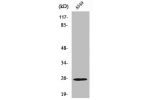 Western Blot analysis of Jurkat cells using Rho GDI? Polyclonal Antibody