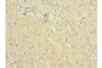 Immunohistochemistry of paraffin-embedded human liver tissue using CSB-PA003995LA01HU at dilution of 1:100