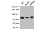 Western Blot<br />
Positive WB detected in: PC-3 whole cell lysate,HepG-2 whole cell lysate,HEK293 whole cell lysate<br />
All lanes: C5AR1 antibody at 30ug/ml<br />
Secondary<br />
Goat polyclonal to rabbit IgG at 1/50000000 dilution<br />
Predicted band
