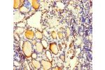Immunohistochemistry of paraffin-embedded human thyroid tissue using CSB-PA004030LA01HU at dilution of 1:100