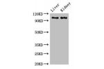 Western Blot<br />
Positive WB detected in:Rat liver tissue,Mouse kidney tissue<br />
All lanes:C6 antibody at 2.7