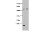 Western blot<br />
All lanes: Cytochrome c oxidase subunit 5B, mitochondrial antibody at 2ug/ml<br />
Lane 1 : EC109 whole cell lysate<br />
Lane 2 : 293T whole cell lysate<br />
Secondary<br />
Goat polyclonal to Rabbit IgG at 1/15000 dilution<br />
Pred