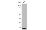 Western Blot analysis of HuvEc cells using SDF-1 Polyclonal Antibody