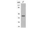 Western Blot analysis of Jurkat cells using SEK1 Polyclonal Antibody
