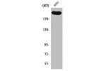 Western Blot analysis of A431 cells using Separase Polyclonal Antibody