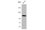 Western Blot analysis of NIH-3T3 cells using SERCA1 Polyclonal Antibody