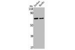 Western Blot analysis of Jurkat HuvEc cells using SMIF Polyclonal Antibody