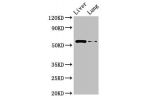 Western Blot<br />
Positive WB detected in:Rat liver tissue,Rat lung tissue<br />
All lanes:CCZ1 antibody at 2.5