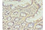 Immunohistochemistry of paraffin-embedded human small intestine tissue using CSB-PA004182LA01HU at dilution of 1:100