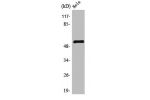 Western Blot analysis of Jurkat cells using TEL Polyclonal Antibody