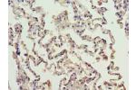 Immunohistochemistry of paraffin-embedded human lung tissue using CSB-PA004261LA01HU at dilution of 1:100