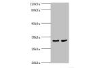 Western blot<br />
All lanes:CA8 antibody at 4ug/ml<br />
Lane 1:mouse skeletal muscle tissue<br />
Lane 2:mouse liver tissue<br />
Secondary<br />
Goat polyclonal to rabbit at 1/10000 dilution<br />
Predicted band size: 33kDa<br />
Observed band size 33k