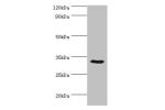 Western blot<br />
All lanes:CA8 antibody at 8ug/ml+mouse liver tissue<br />
Secondary<br />
Goat polyclonal to rabbit at 1/10000 dilution<br />
Predicted band size: 33kDa<br />
Observed band size: 33kDa<br />