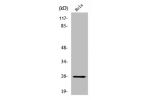 Western Blot analysis of HeLa cells using UMP-CMP Kinase Polyclonal Antibody