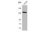 Western Blot analysis of HepG2 cells using a-protein Kinase 1 Polyclonal Antibody