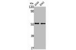 Western Blot analysis of A549 K562 cells using ALDH3A1 Polyclonal Antibody