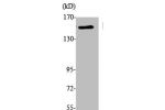 Western Blot analysis of K562 cells using EEA1 Polyclonal Antibody
